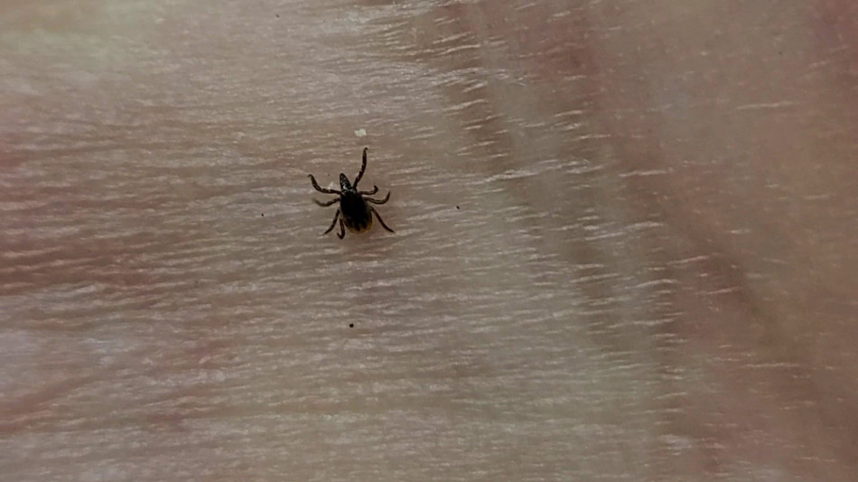 tick crawling on my hand